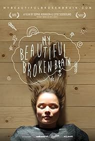 My Beautiful Broken Brain (2016) watch-My Beautiful Broken Brain (2016)
